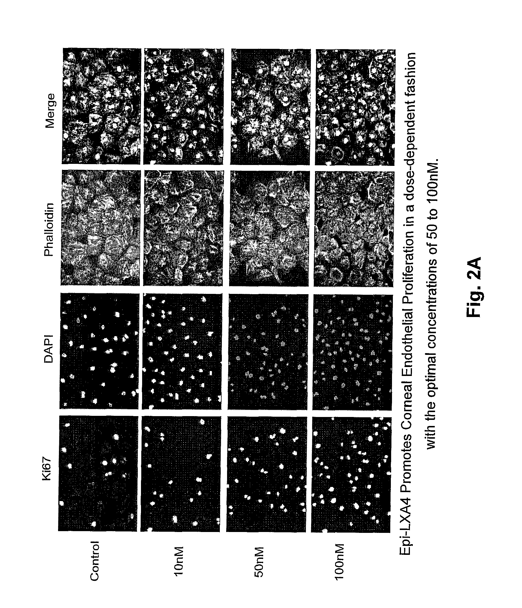 Lipoxin A4 protection for cornea endothelial cells