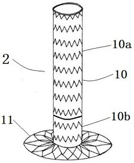 A combination device for aortic arch with branched stent-graft for open surgery