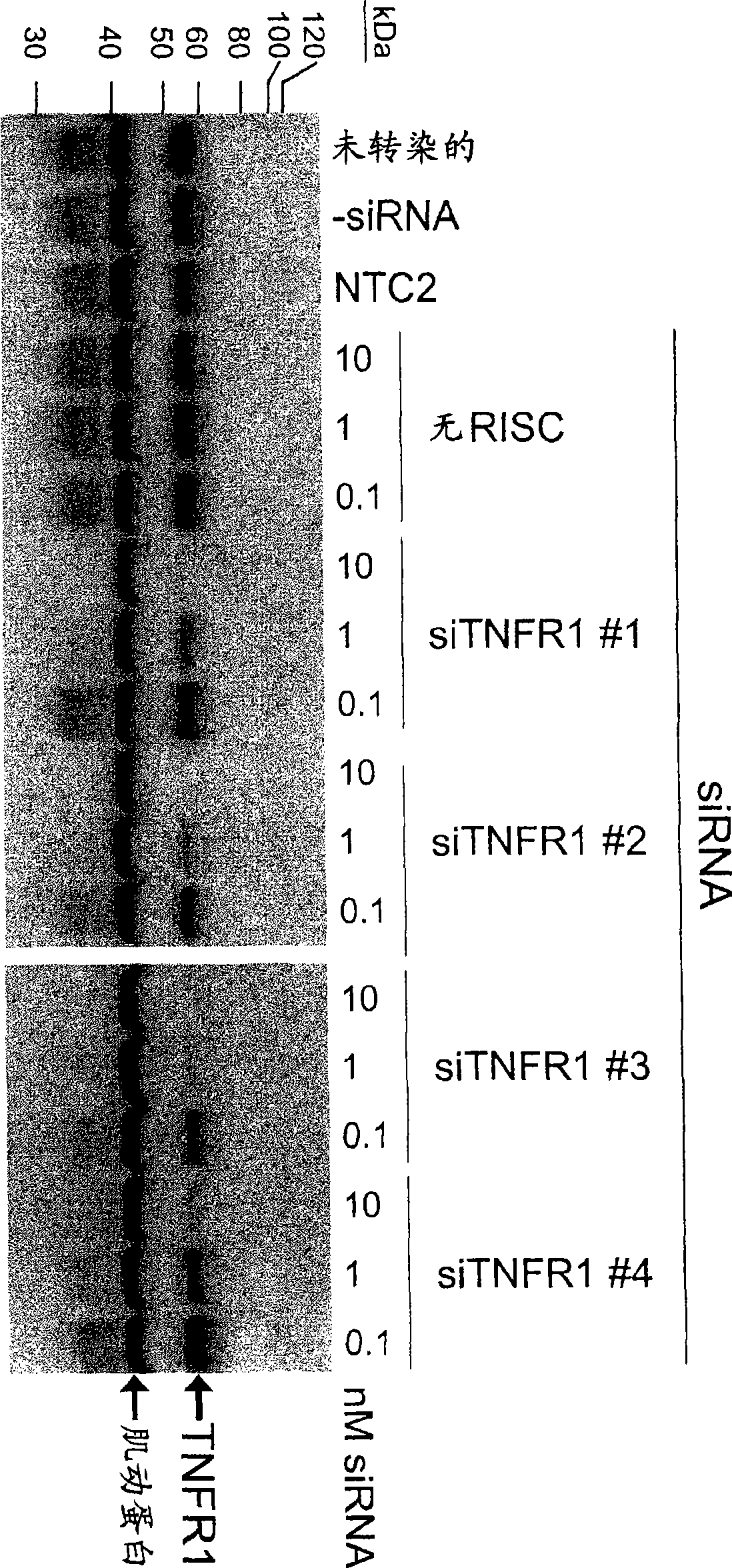 RNAi-mediated inhibition of tumor necrosis factor alpha-related conditions