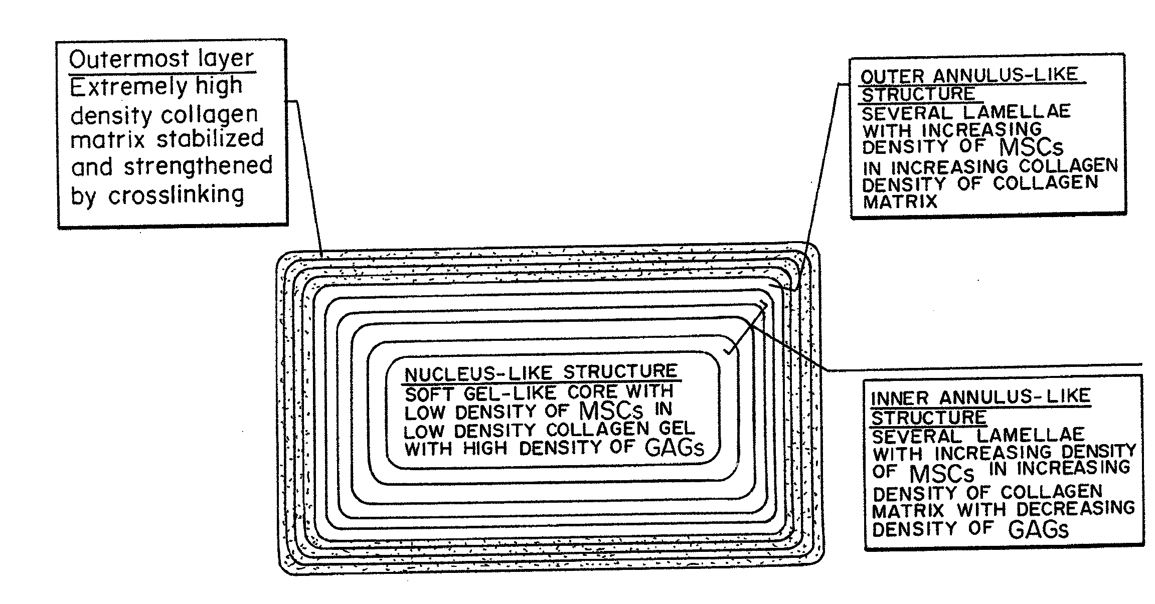 Bioengineered Intervertebral Discs and Methods for Their Preparation