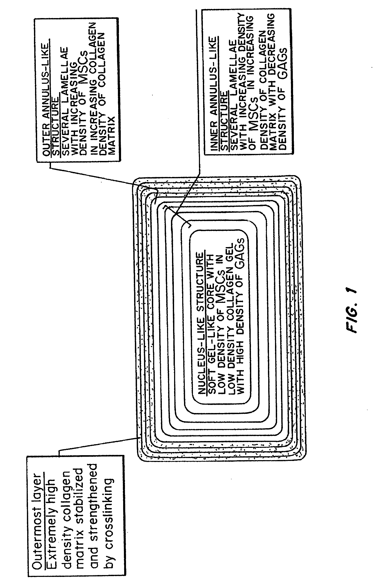 Bioengineered Intervertebral Discs and Methods for Their Preparation