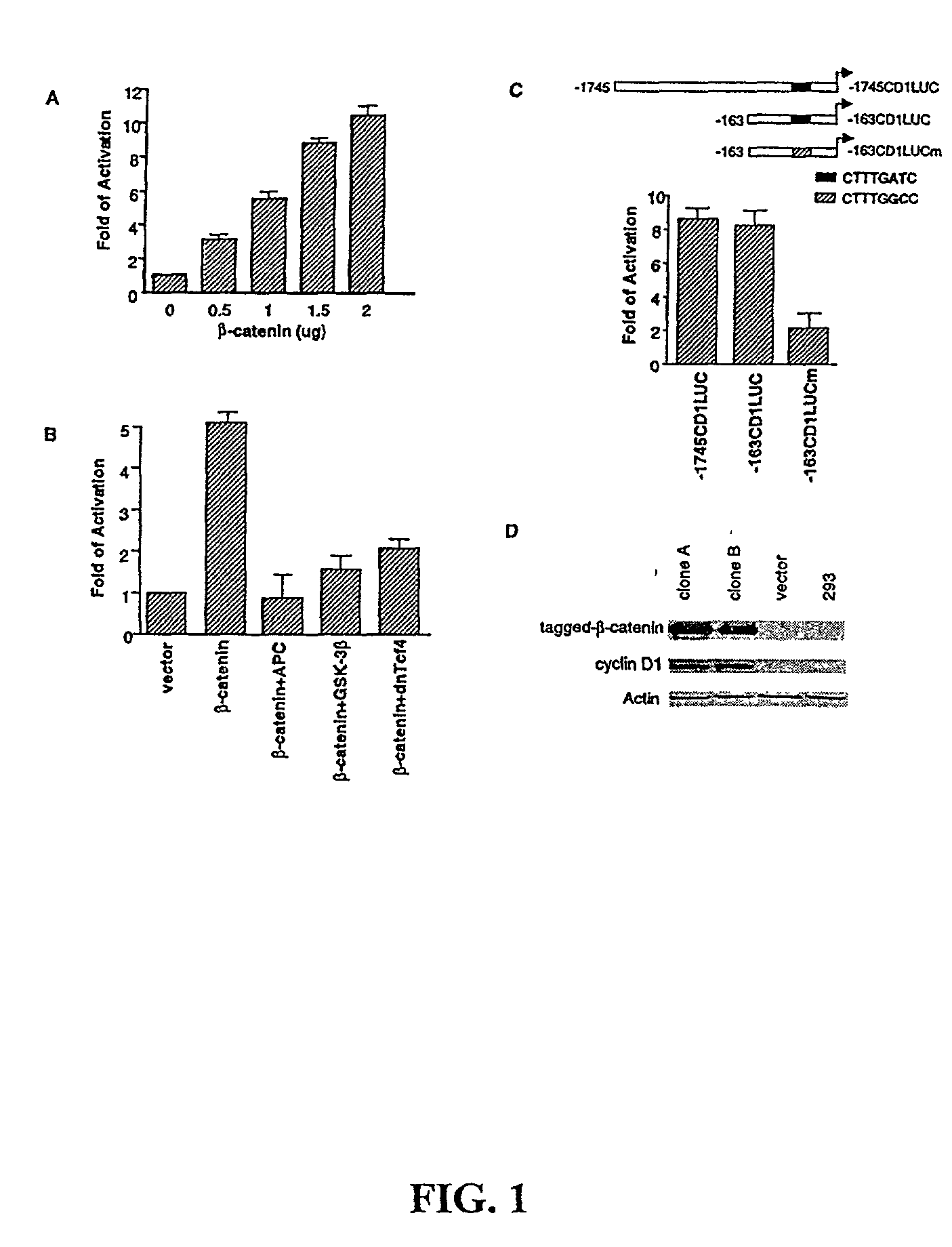 Beta-catenin is a strong and independent prognostic factor for cancer