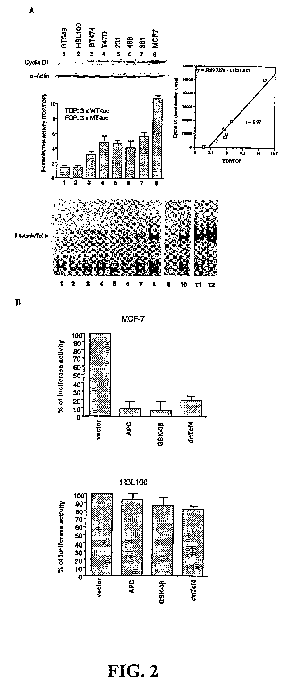 Beta-catenin is a strong and independent prognostic factor for cancer