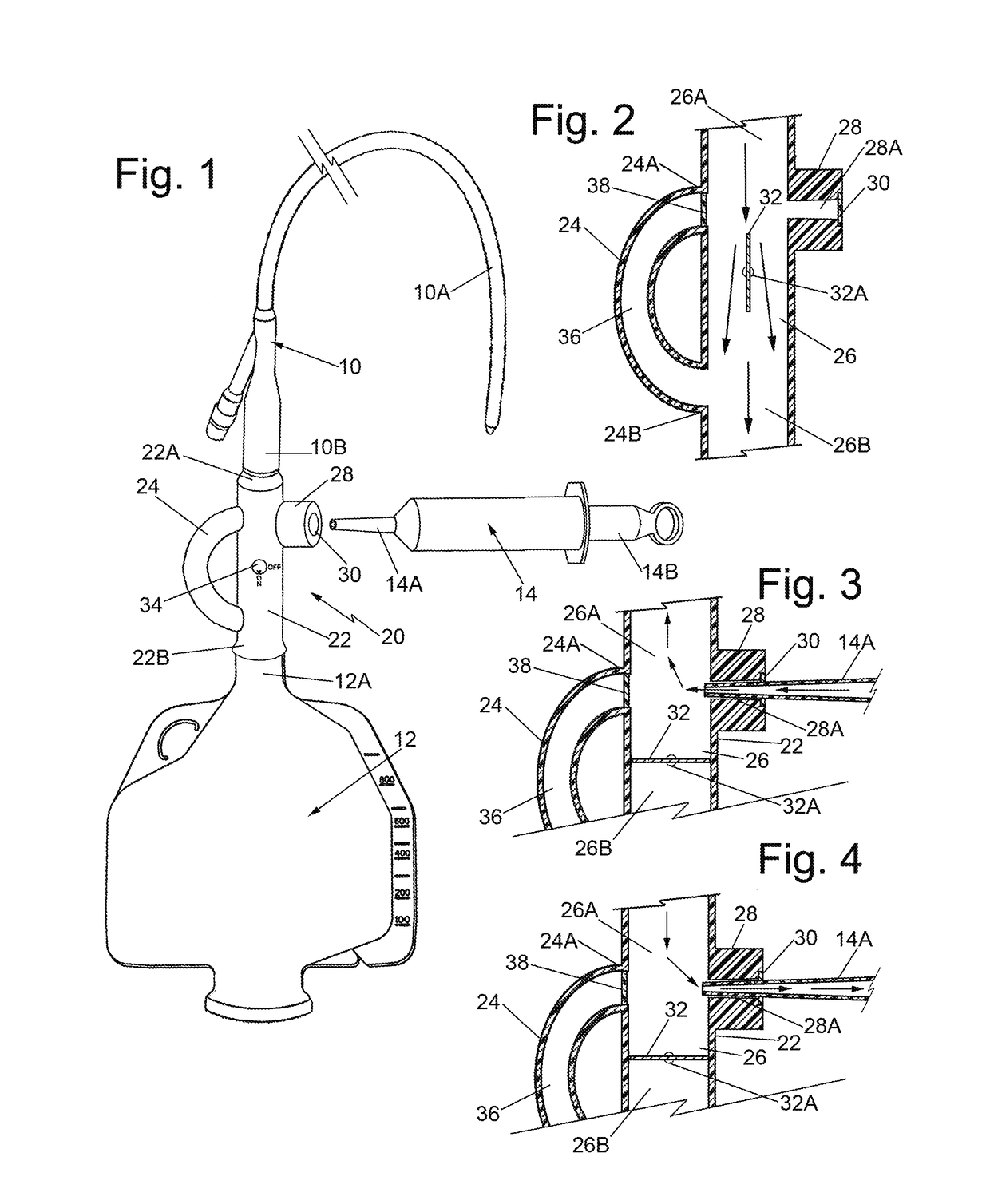 Urinary catheter irrigation device and method of irrigating a urinary catheter