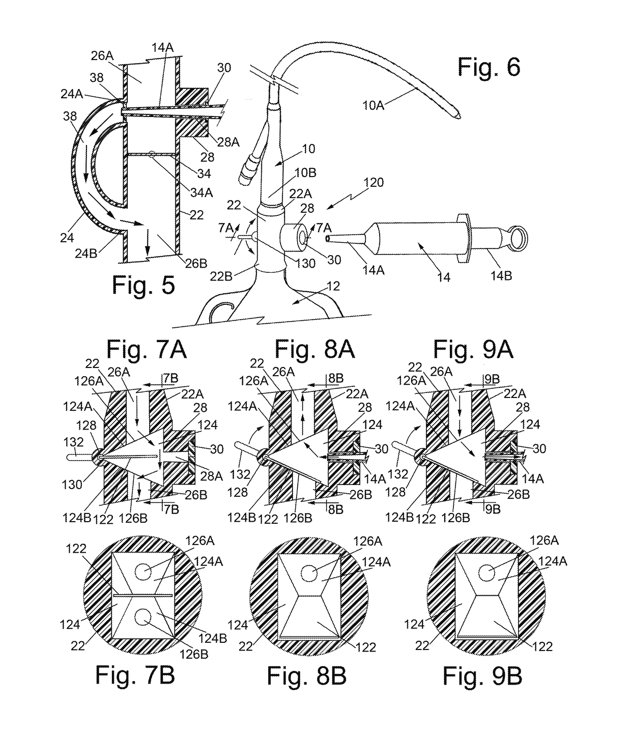 Urinary catheter irrigation device and method of irrigating a urinary catheter