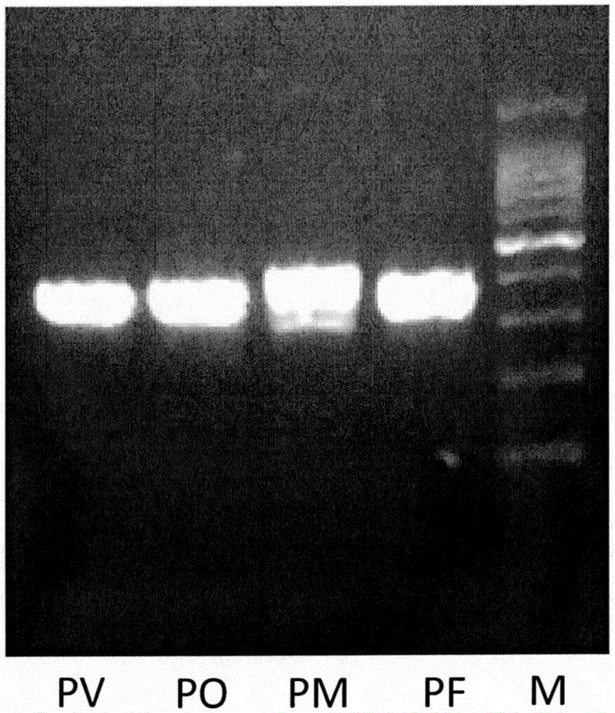 Probes, kits and methods for typing and detecting four types of human malaria parasites