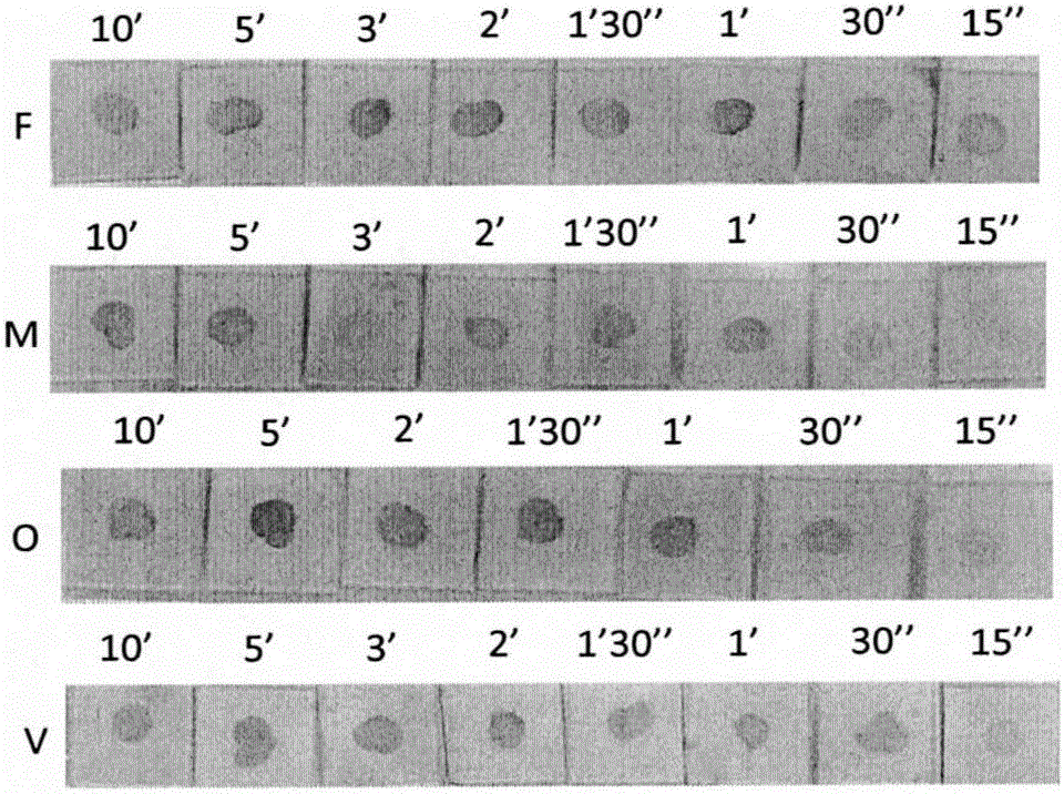 Probes, kits and methods for typing and detecting four types of human malaria parasites