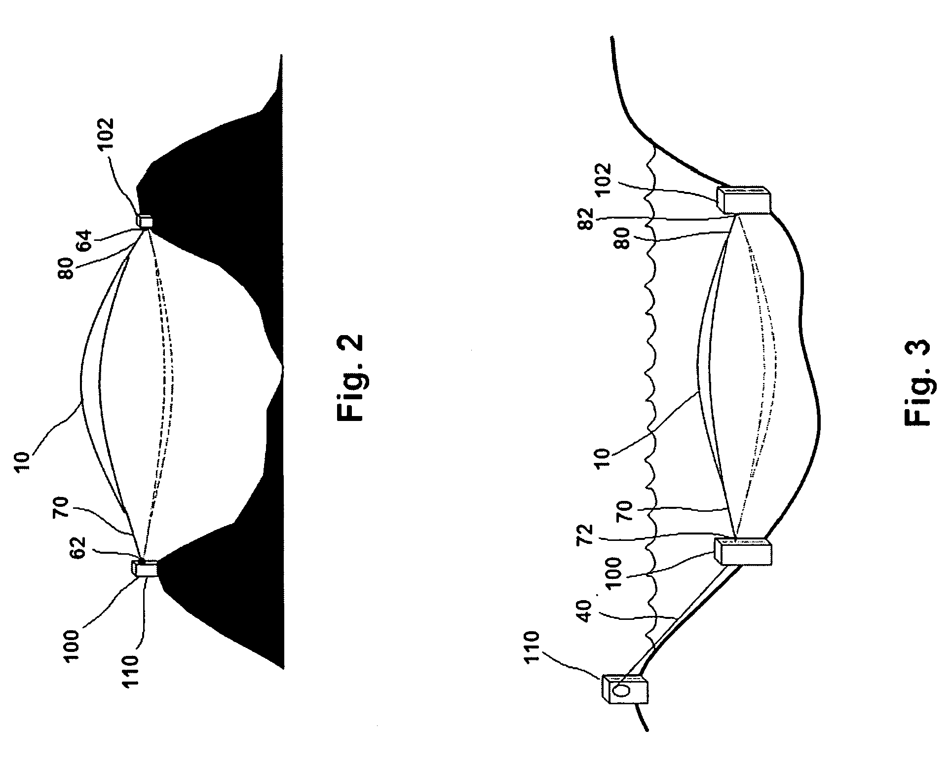 Rotating flexible wing power system