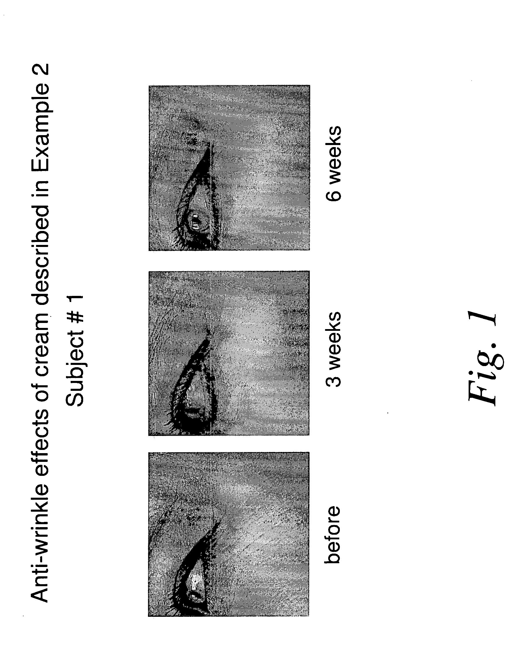 Nicotinamide compositions for treatment of skin diseases and disorders