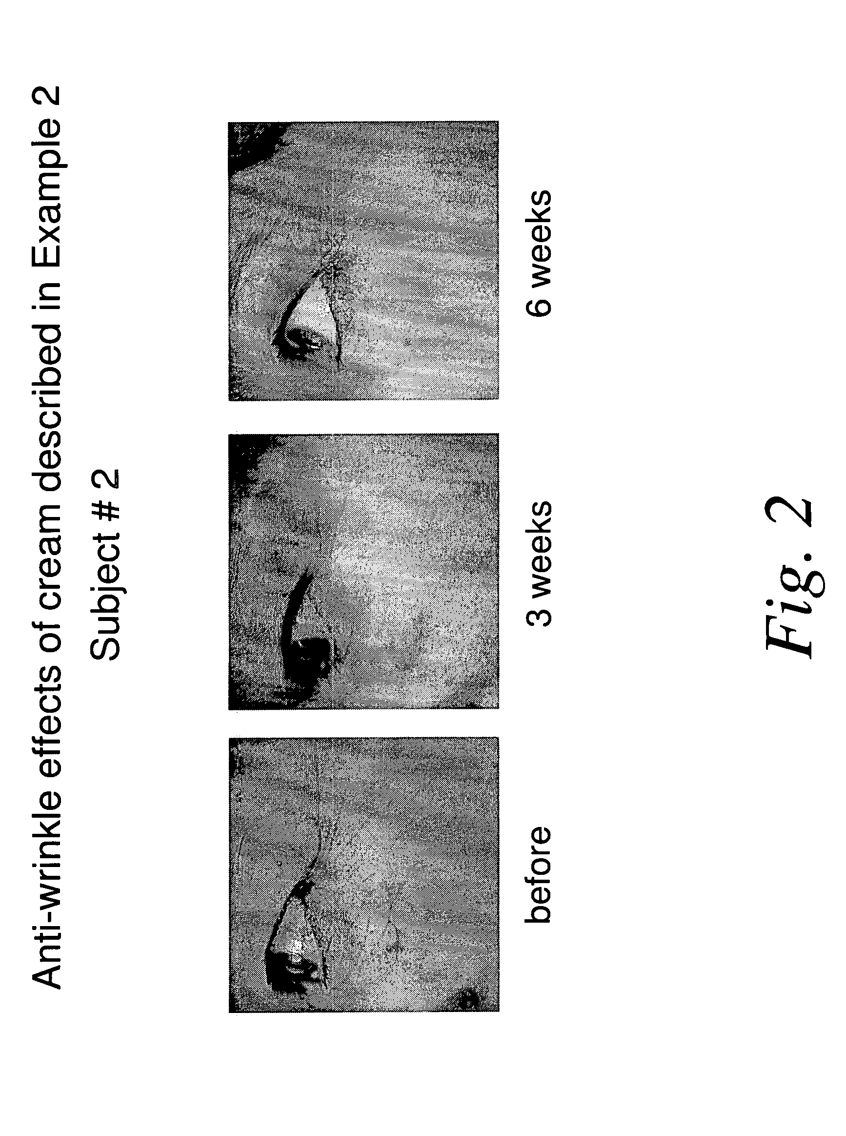 Nicotinamide compositions for treatment of skin diseases and disorders