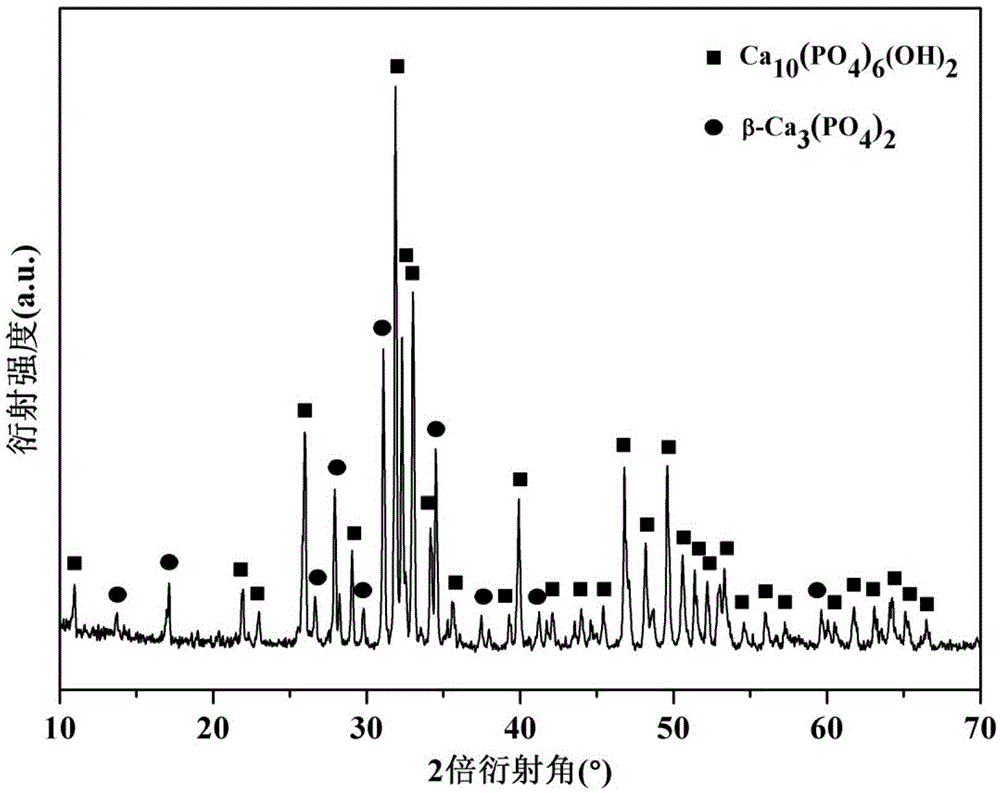 Two-phase calcium phosphate composite material adopting graphene and carbon nano-tube as synergistic toughening phases and preparation method of composite material