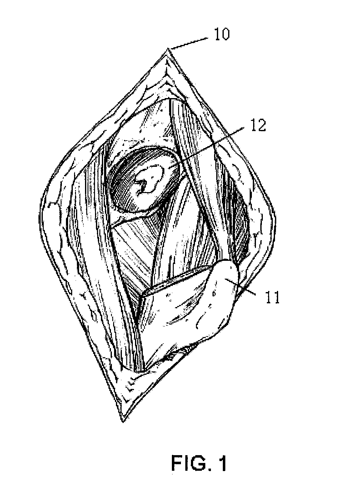 Apparatus and method for minimally invasive total joint replacement