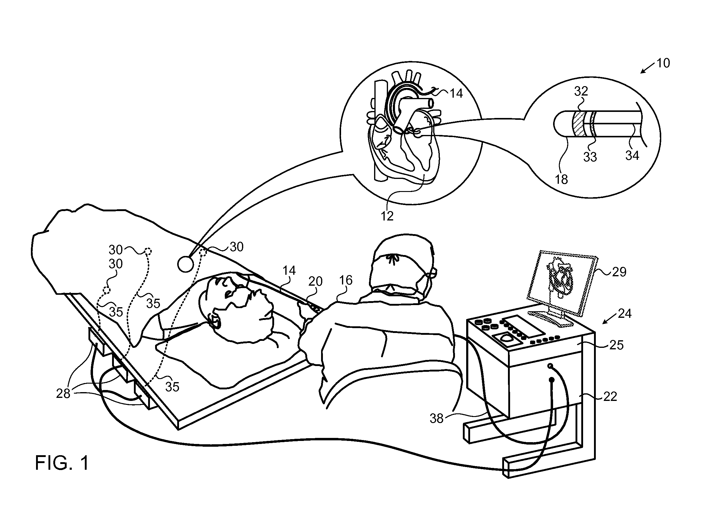 Model based reconstruction of the heart from sparse samples