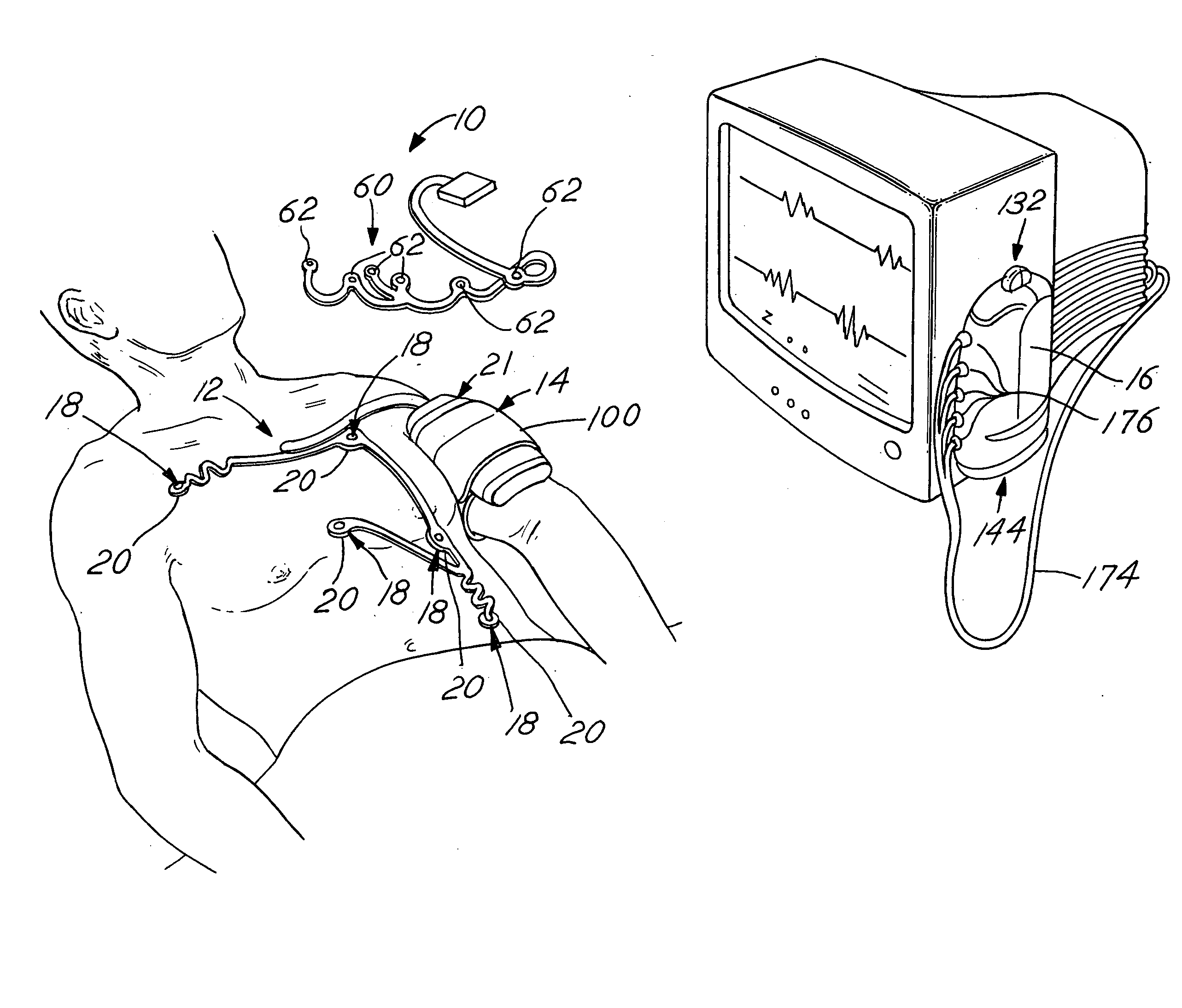 Wireless ECG system