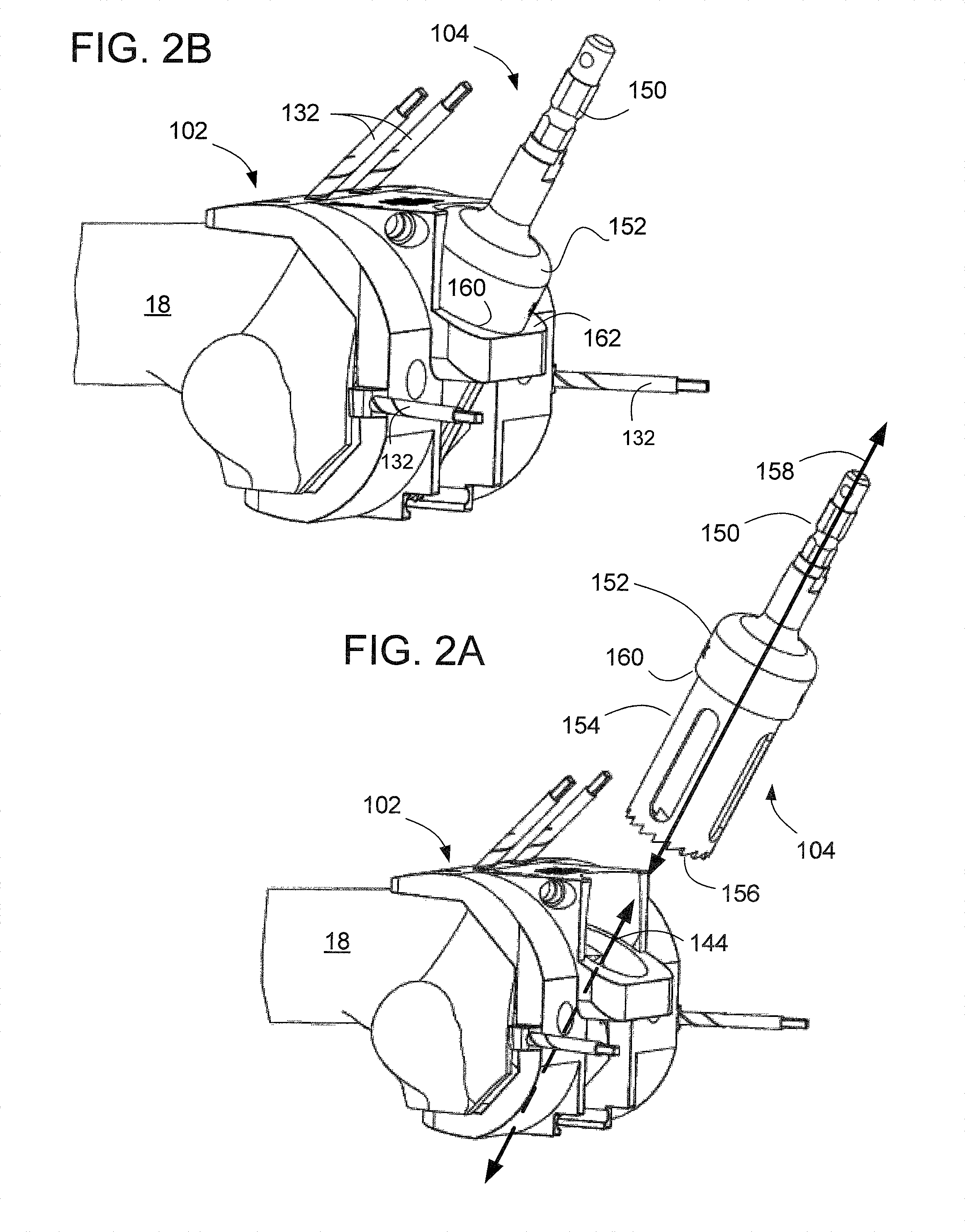 Methods and apparatus for preparing an intercondylar area of a distal femur