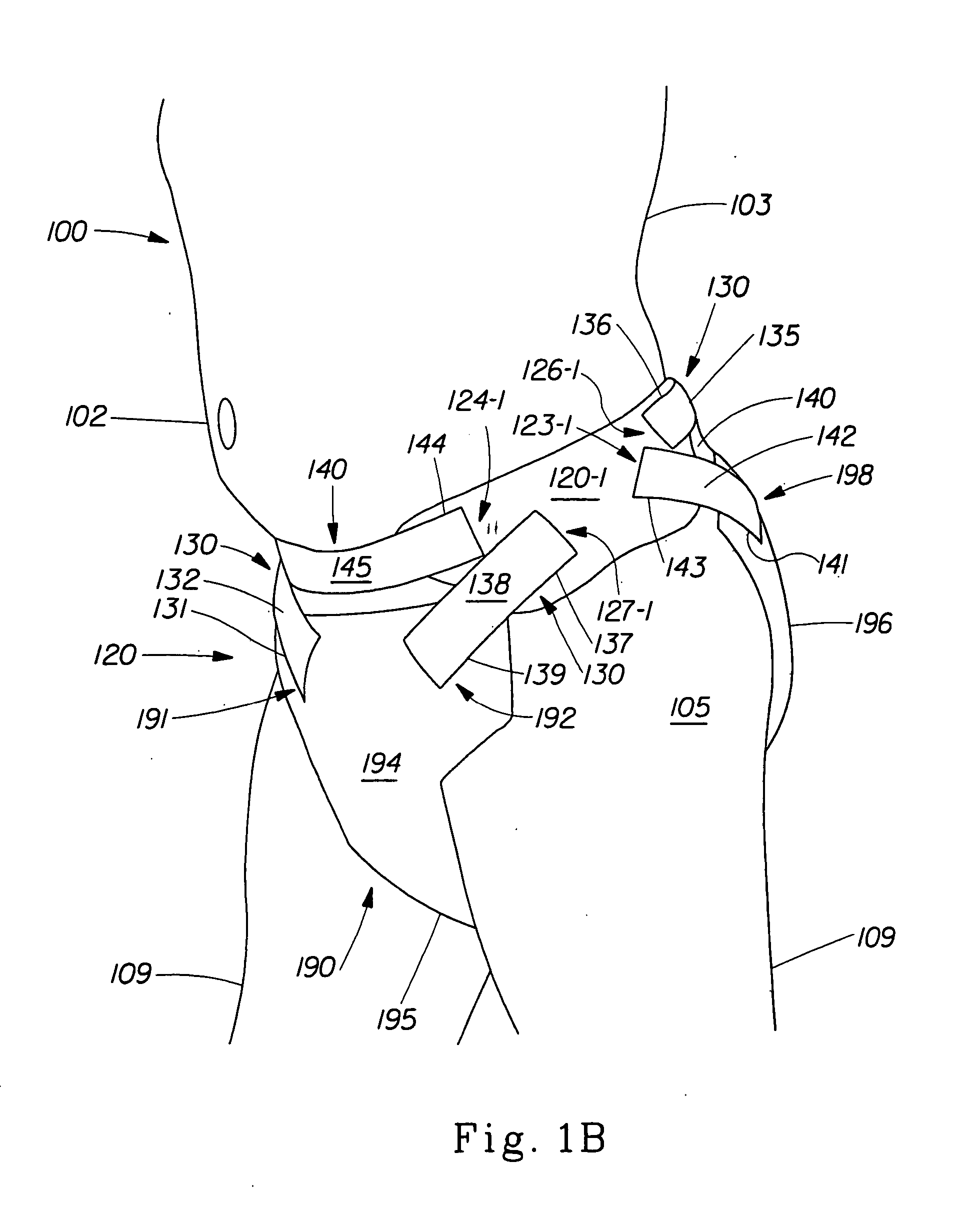 Disposable wearable absorbent articles with anchoring systems