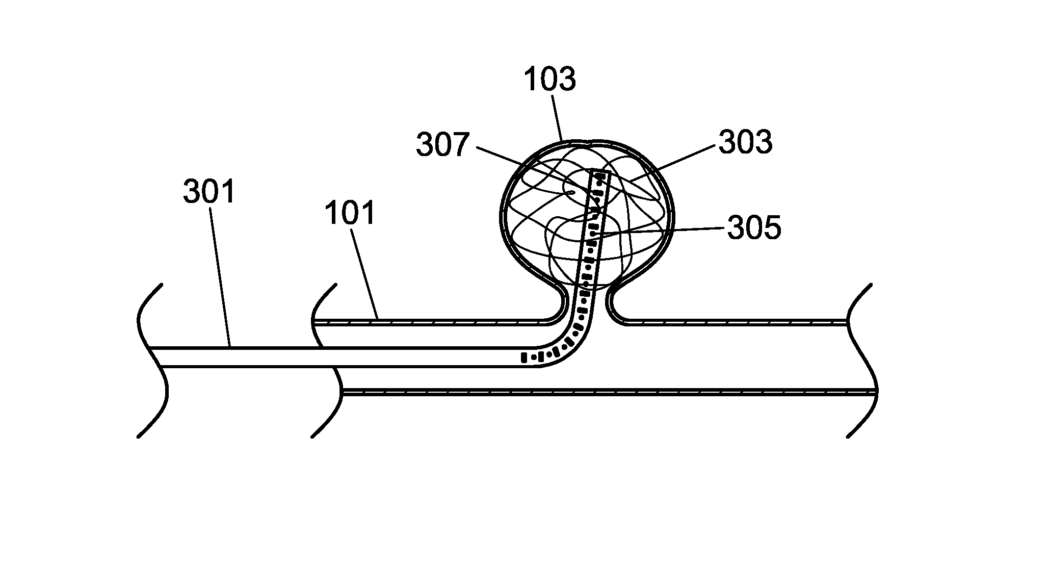 Catheter Detection, Tracking And Virtual Image Reconstruction