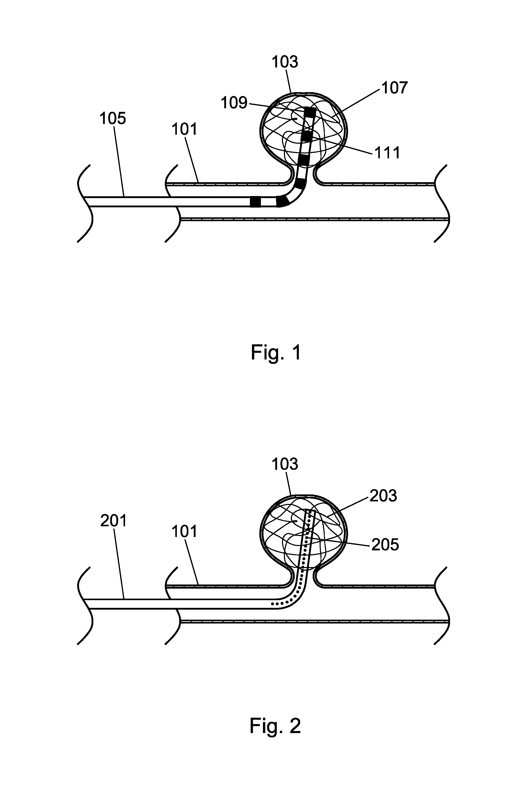 Catheter Detection, Tracking And Virtual Image Reconstruction