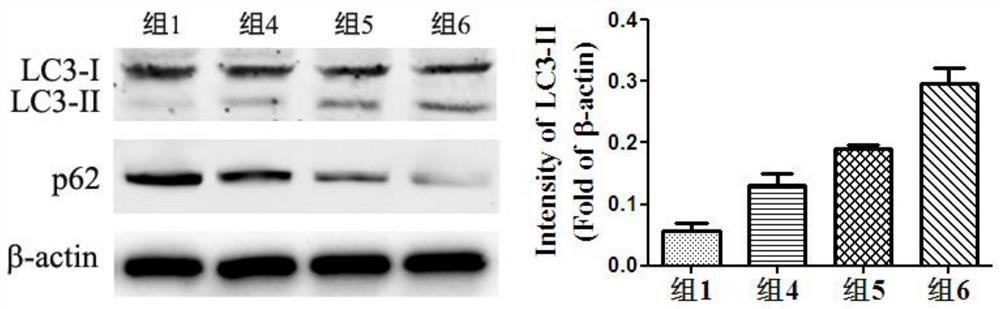 A transport preservation solution and preparation method for maintaining the activity of mesenchymal stem cells