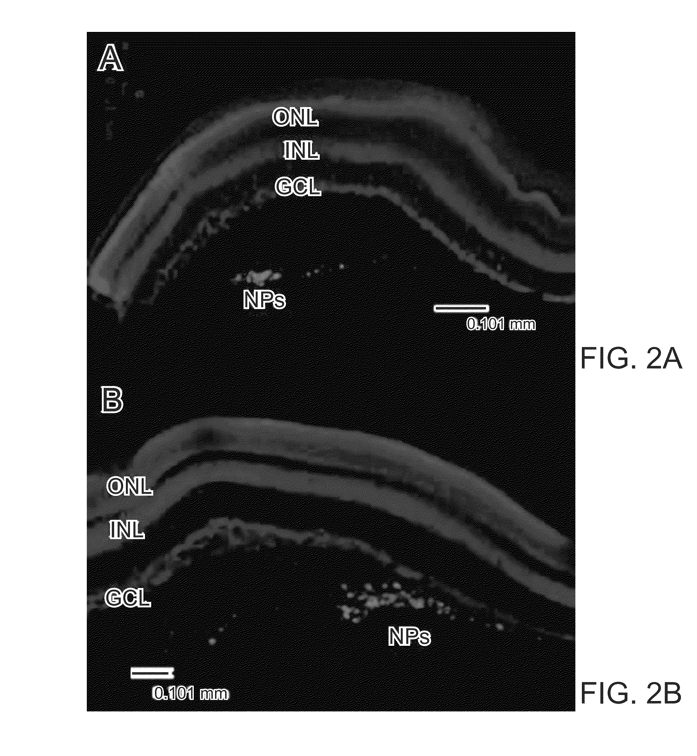 Nanoparticle composition and methods to make and use the same