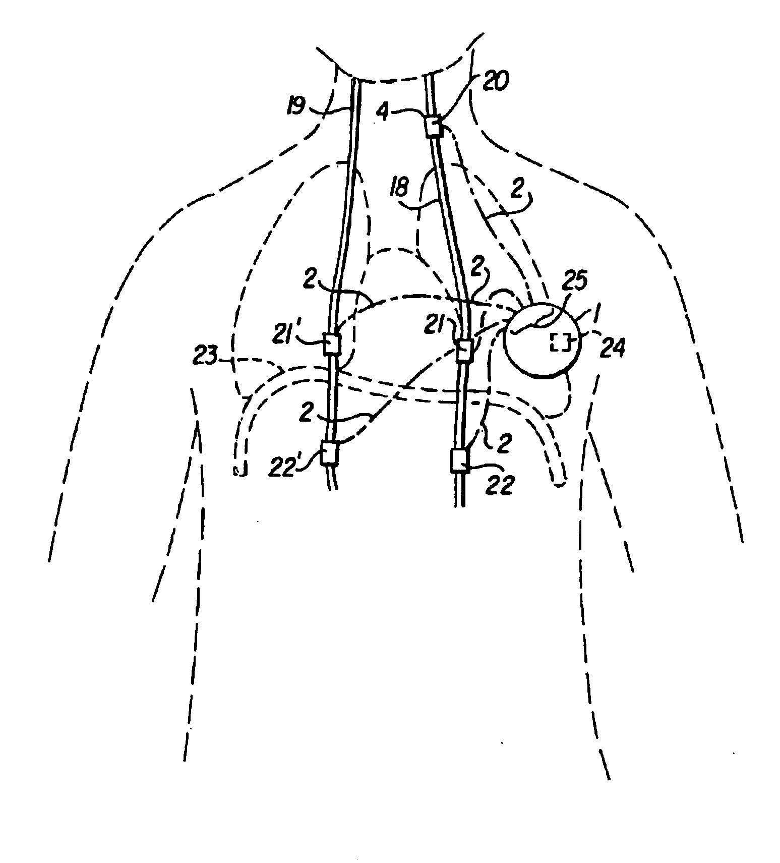 Modulation of drug effects by vagus nerve stimulation