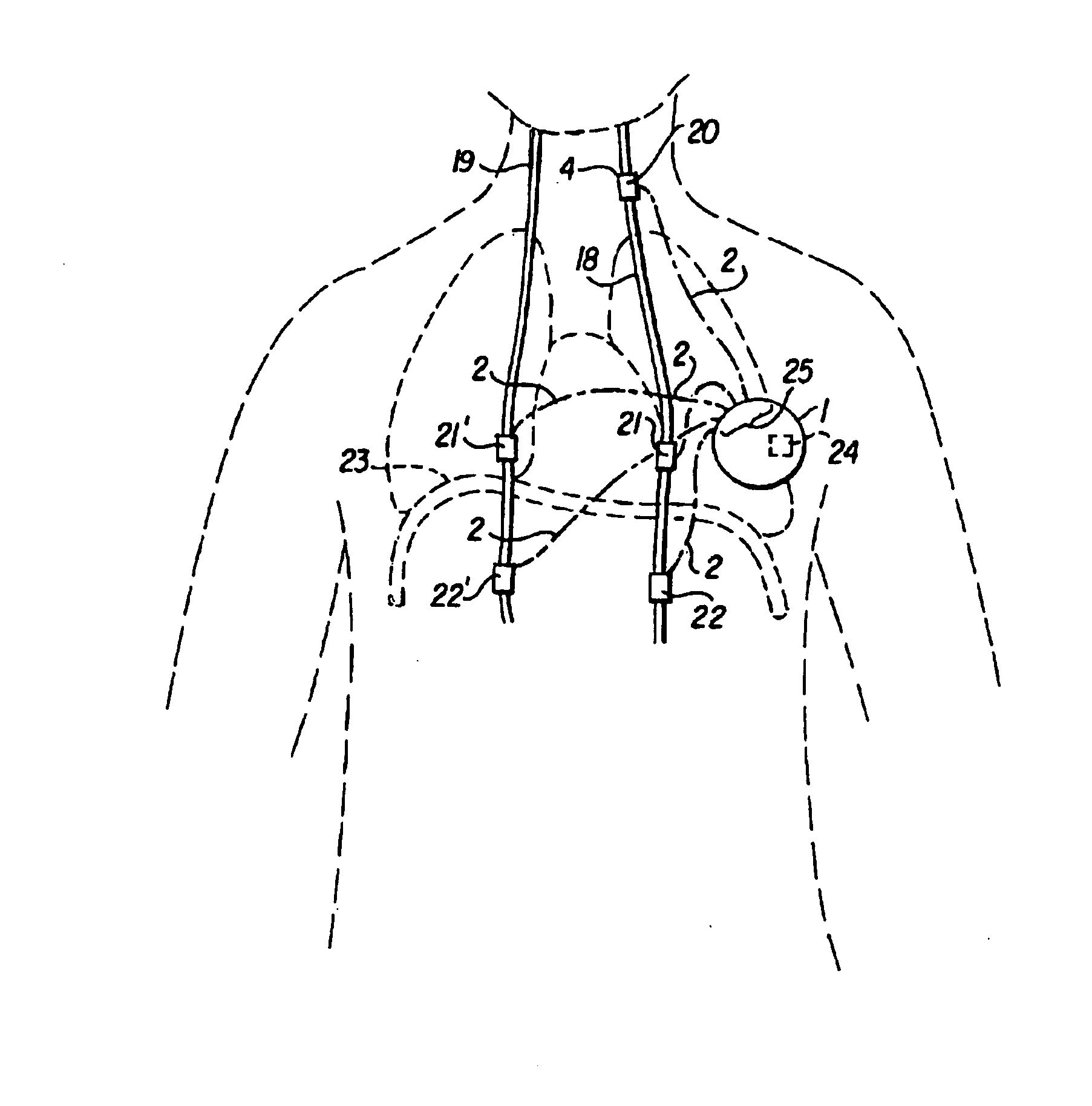 Modulation of drug effects by vagus nerve stimulation