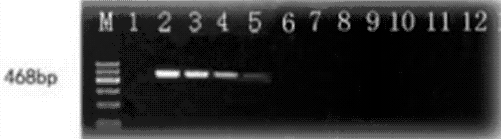 Method for rapidly detecting pathogenic anthracnose of dracaena sanderiana and application thereof