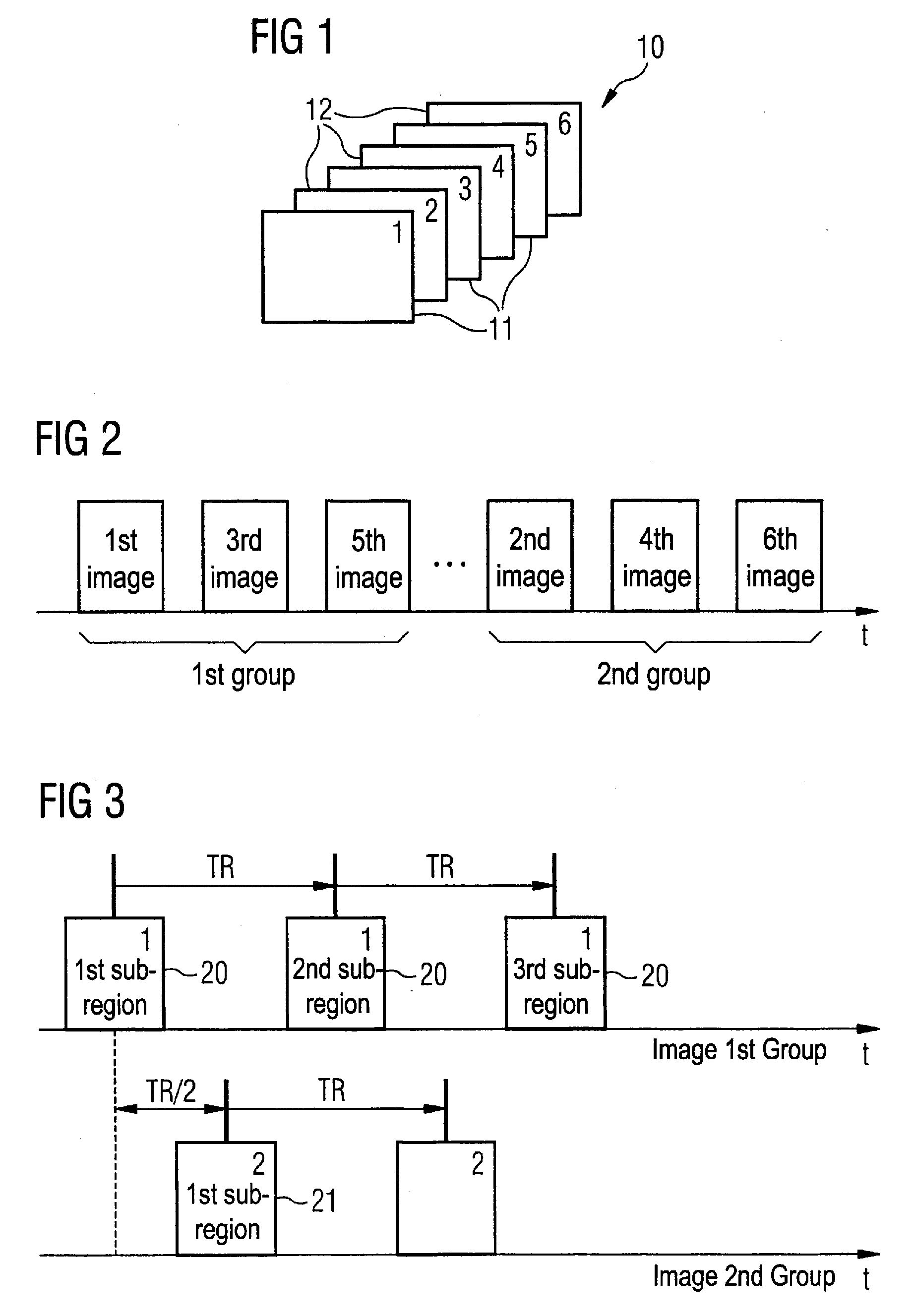 Magnetic resonance system and method for correction of movement artifacts