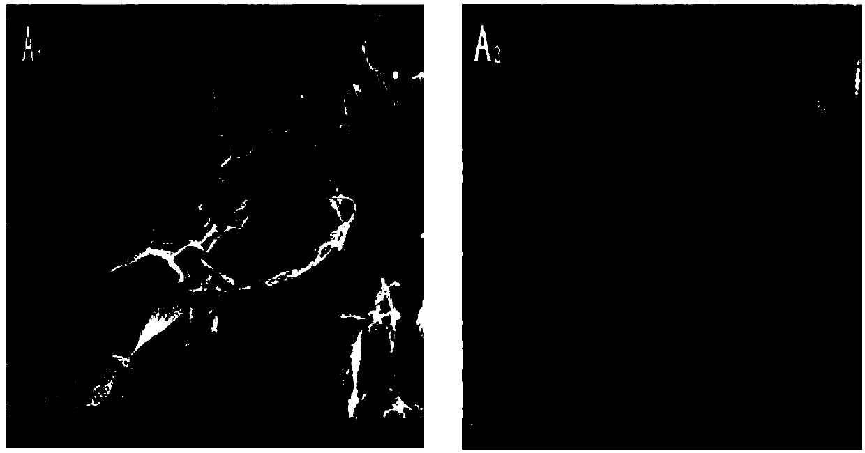 Biological compound material based on fish skin collagen and preparation method of biological compound material