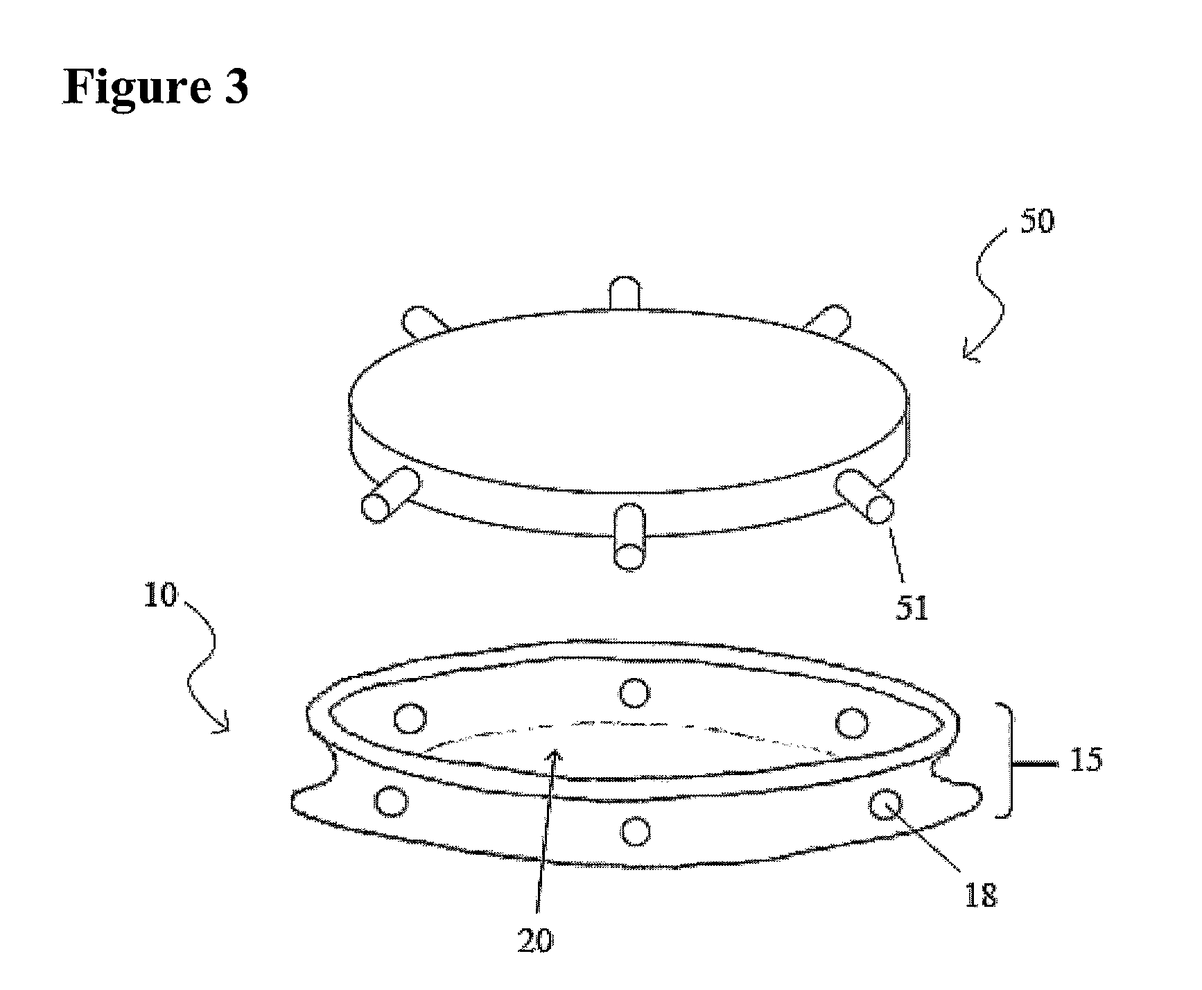 Capsular Implant For Maintaining The shape and/or Position of an Opening Formed by Capsulorhexis