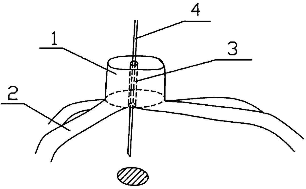 A 3D-printed in vitro auxiliary positioning device for pulmonary masses and its preparation method