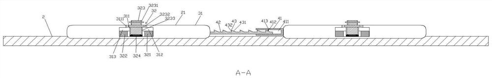 A fixation device with absorbable rib plate