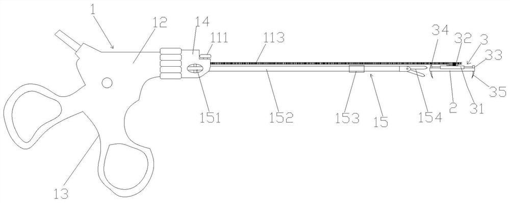 A fixation device with absorbable rib plate