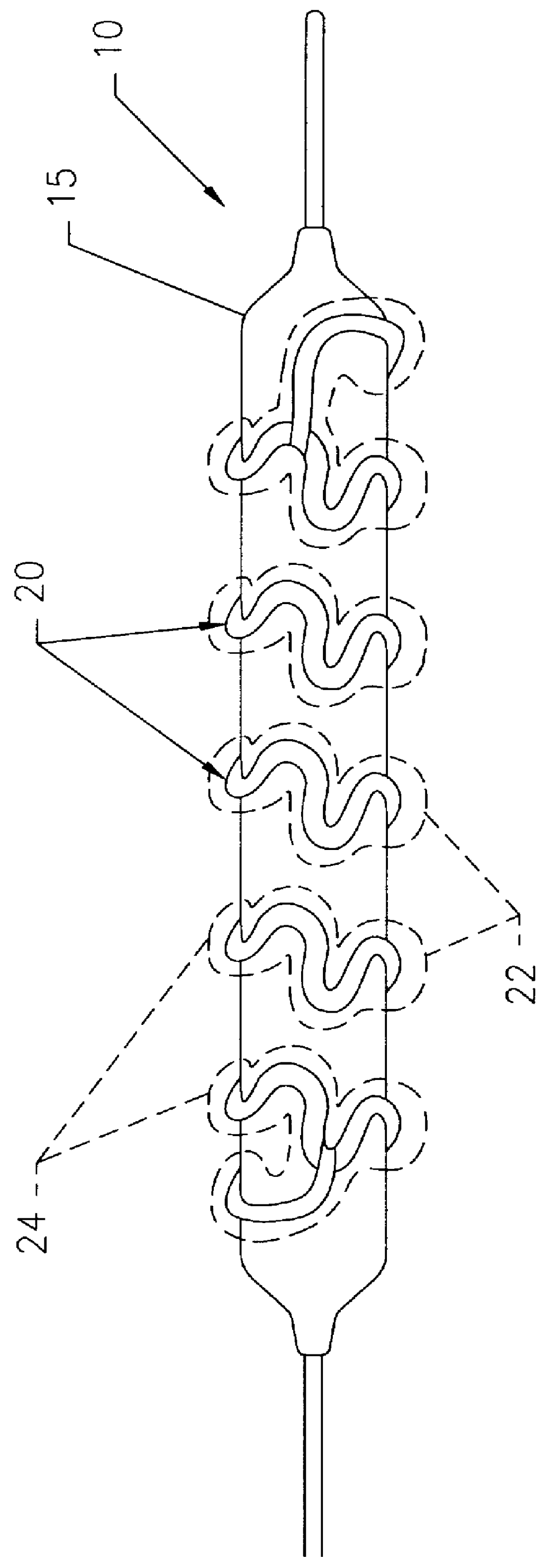 Medical device for delivering localized radiation