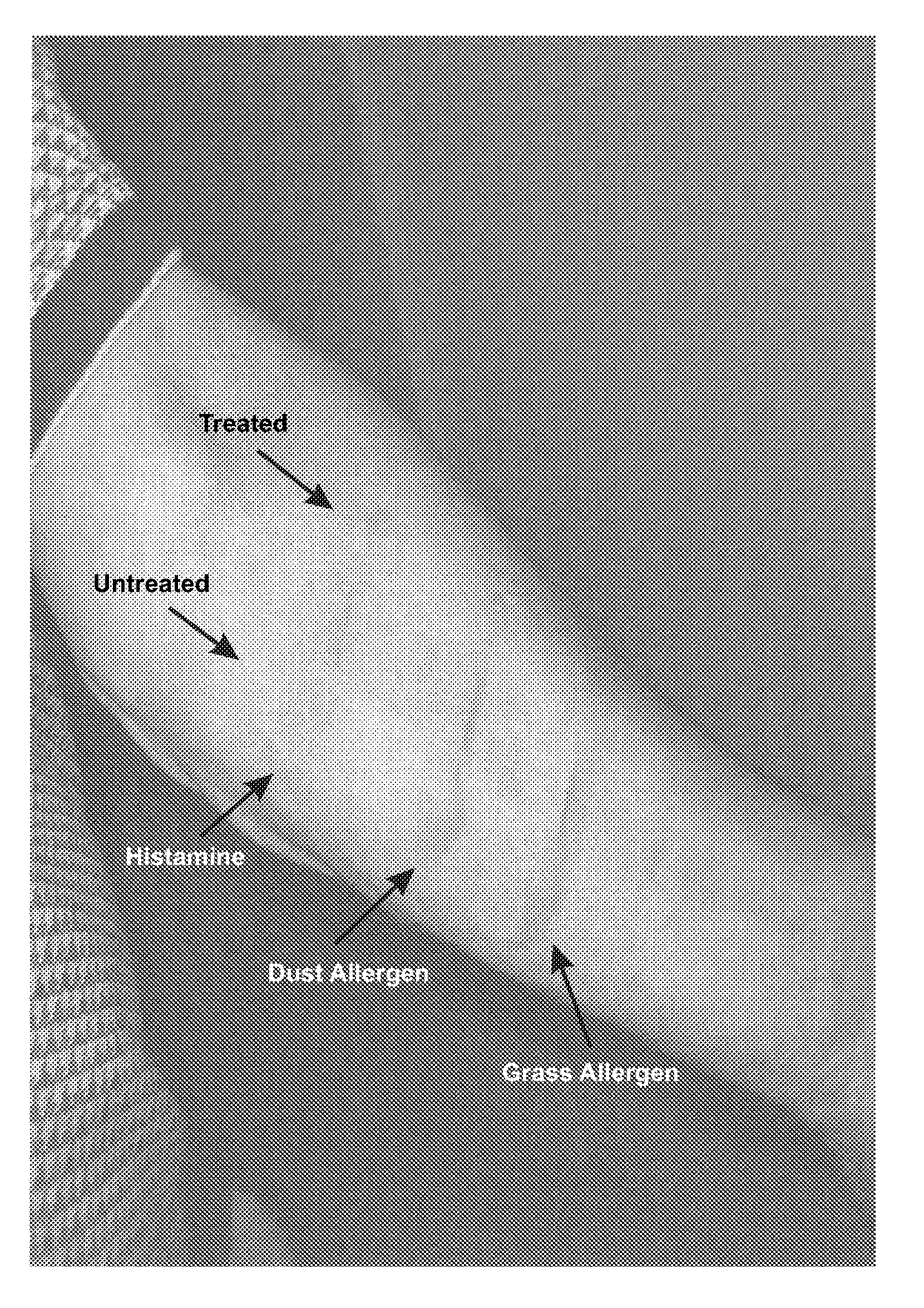 Compositions and methods for the treatment of inflammatory conditions