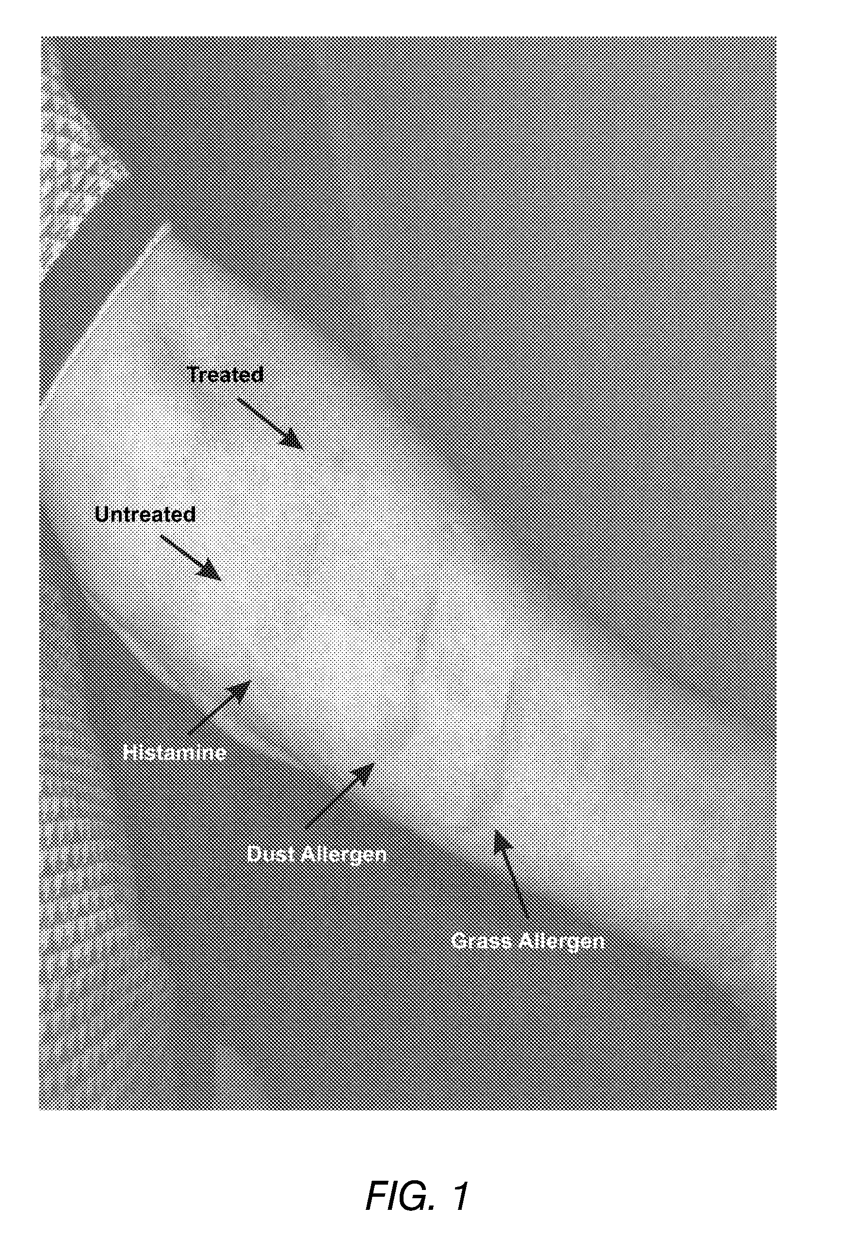 Compositions and methods for the treatment of inflammatory conditions