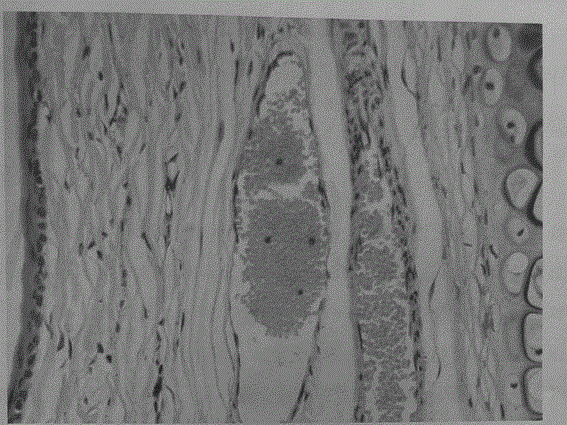 Omeprazole sodium microspheric freeze-dried preparation for injection and method for preparing omeprazole sodium microspheric freeze-dried preparation for injection