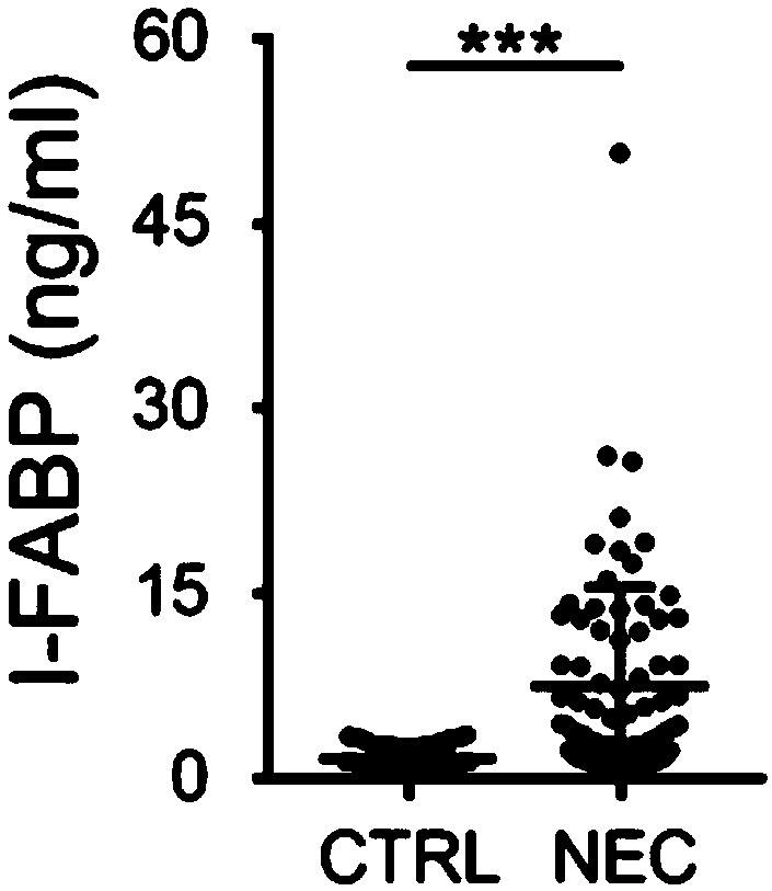 Peripheral blood inflammatory biomarker I-FABP for detecting necrotizing enterocolitis of newborn (NEC) and application thereof