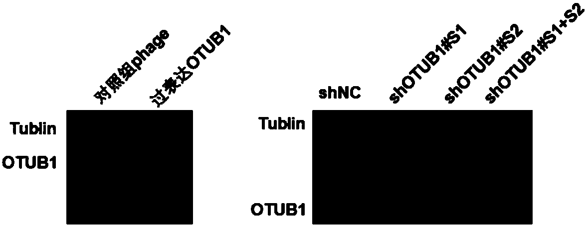 Application of OTU Domain-Containing Ubiquitin Aldehyde-Binding Protein 1 in preparation of medicines for treating fatty liver and related diseases