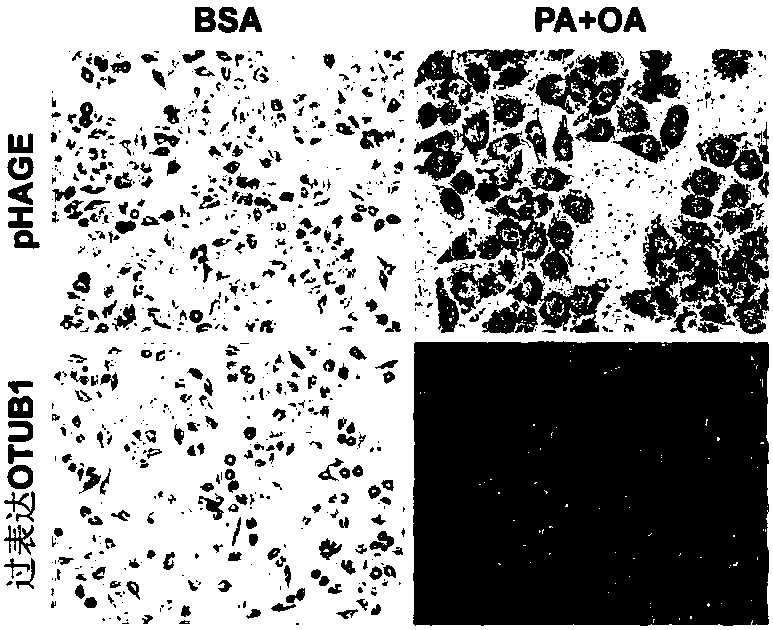 Application of OTU Domain-Containing Ubiquitin Aldehyde-Binding Protein 1 in preparation of medicines for treating fatty liver and related diseases