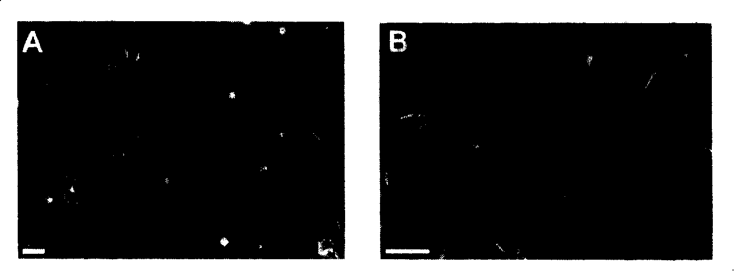 Human placental nutritive layer cell line and its use