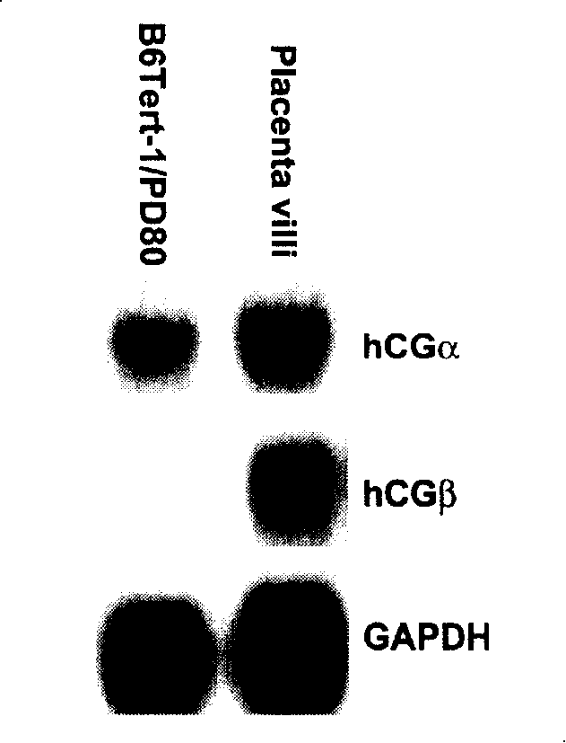 Human placental nutritive layer cell line and its use