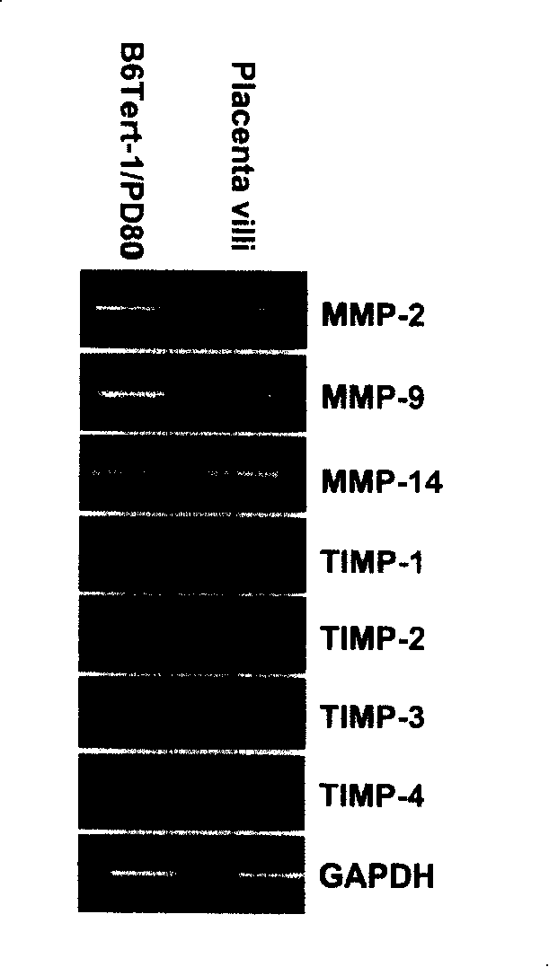 Human placental nutritive layer cell line and its use