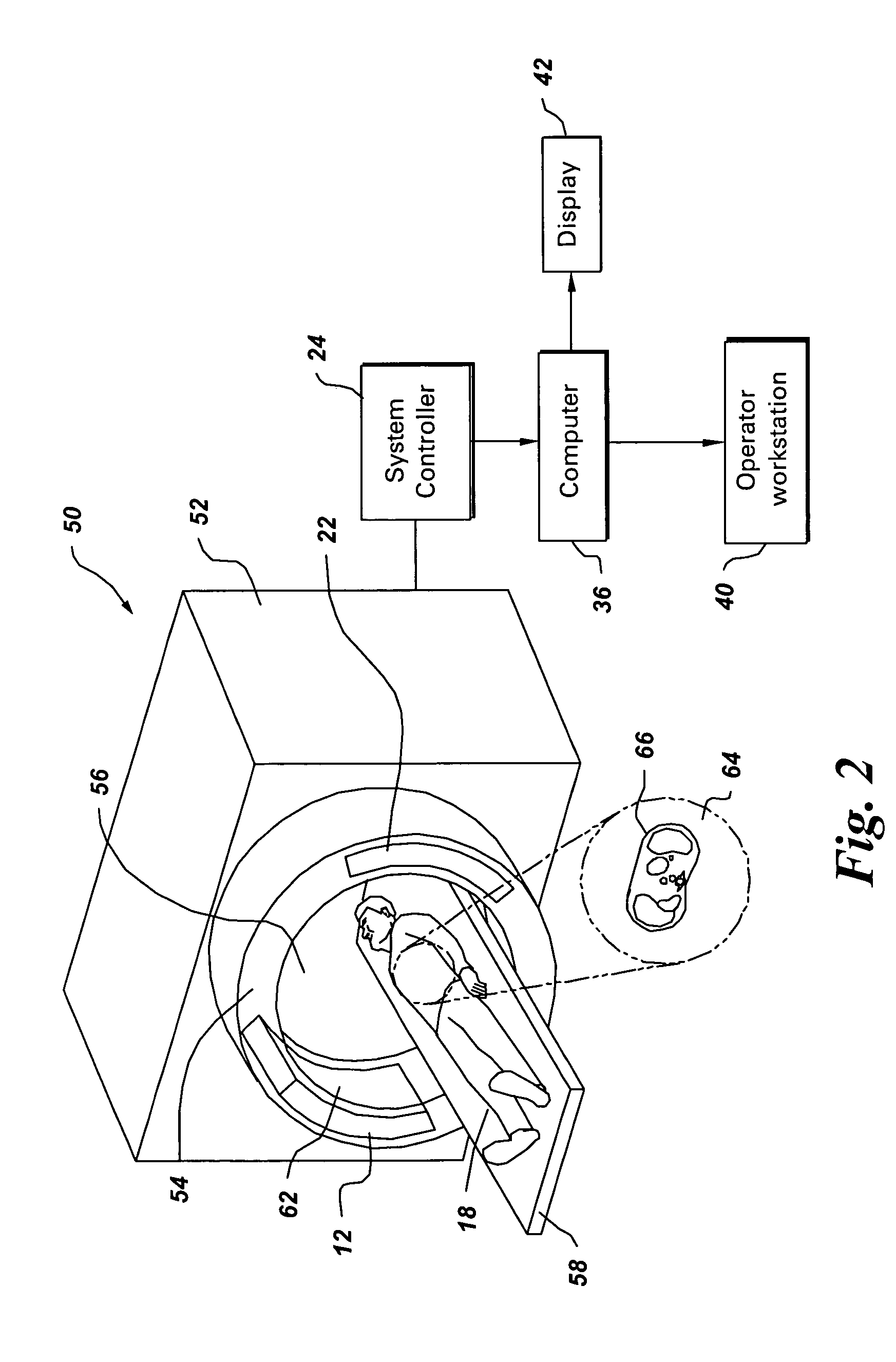 Method and system for CT imaging using a distributed X-ray source and interpolation based reconstruction