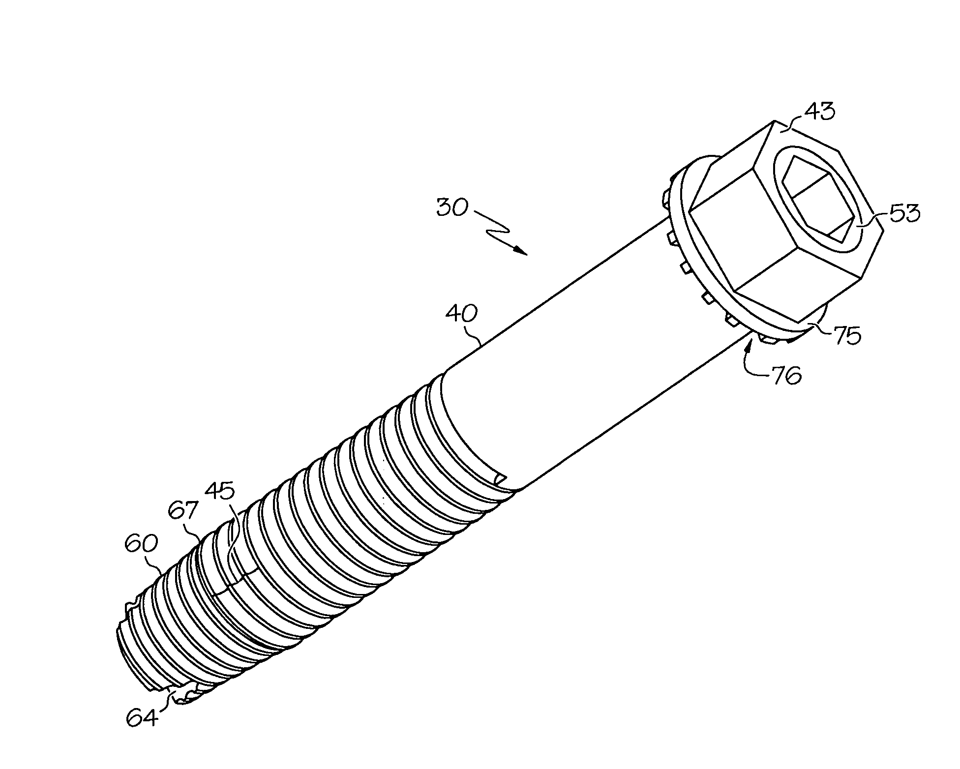 Spinal facet fixation device