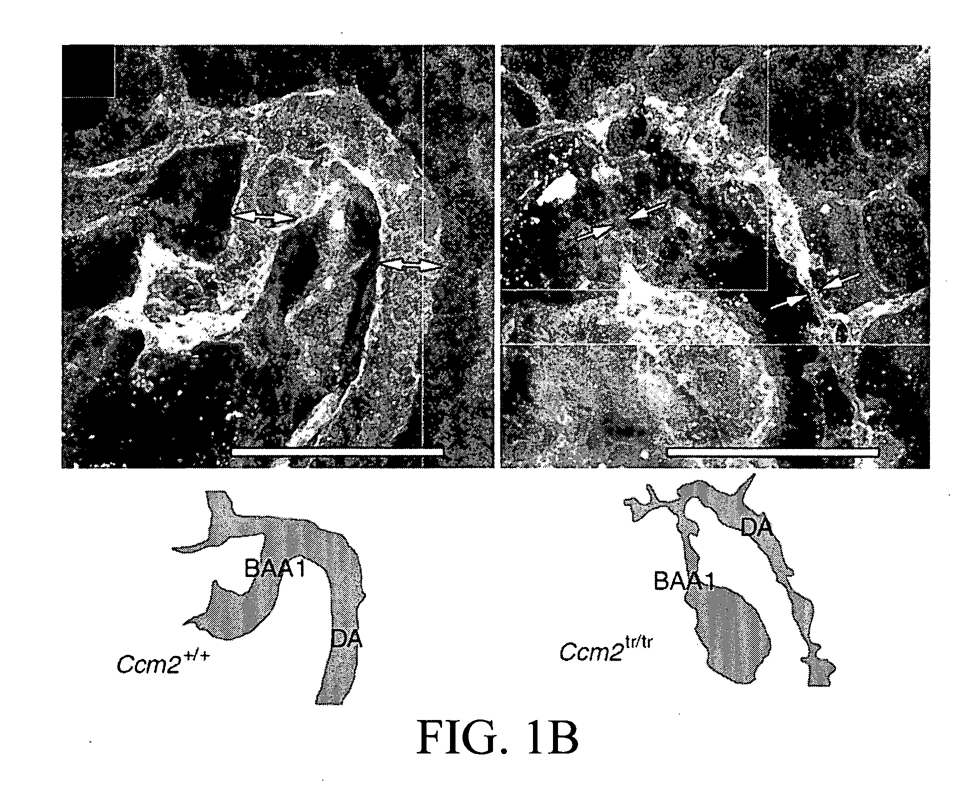 Pharmacological targeting of vascular malformations