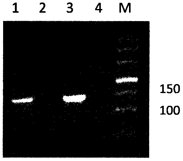 Nucleic acid diagnosis kit for detecting schistosoma japonicum and detection method with nucleic acid diagnosis kit