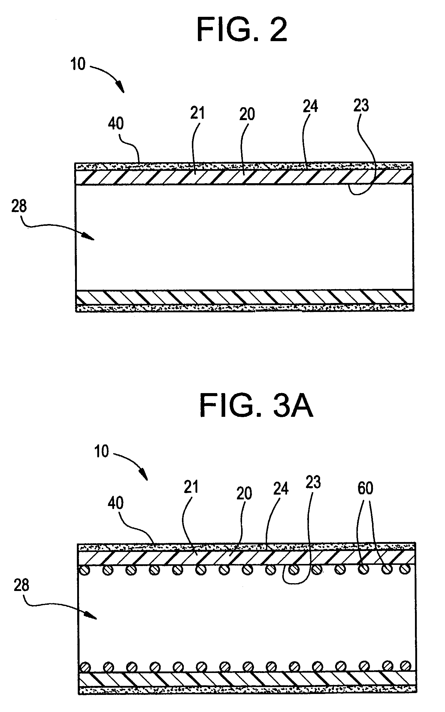 Intraluminal lining