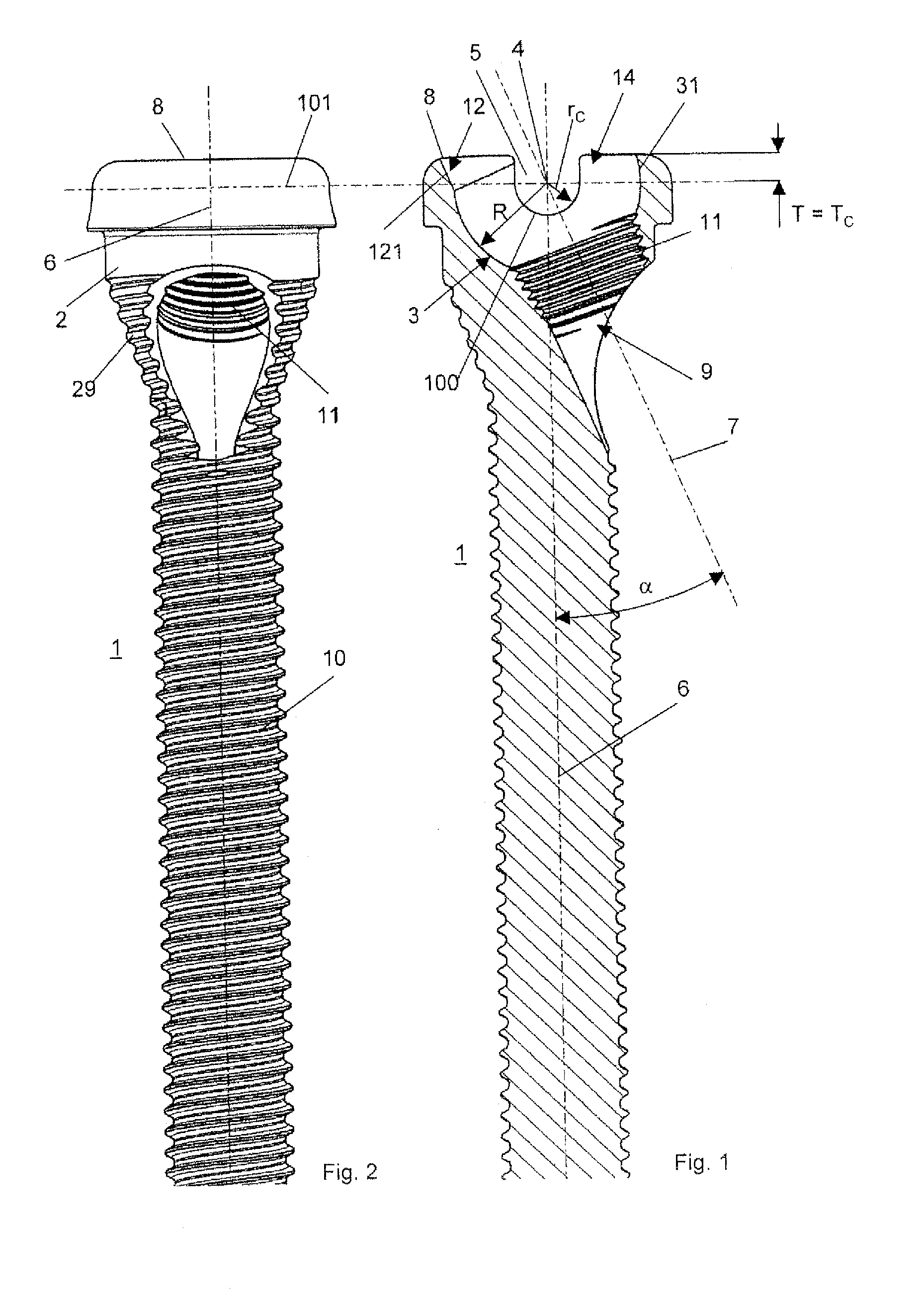 Bone Screw Assembly and Instruments for Implantation of the Same