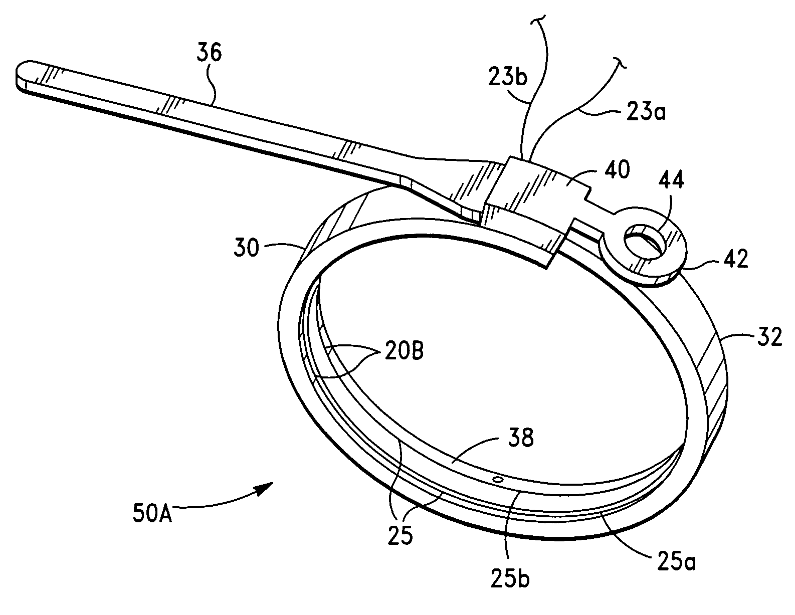 Gastric restriction method and system for treatment of eating disorders